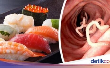 Ini Risiko Makan Sushi Menurut Dokter, Bisa Terjangkit Parasit!